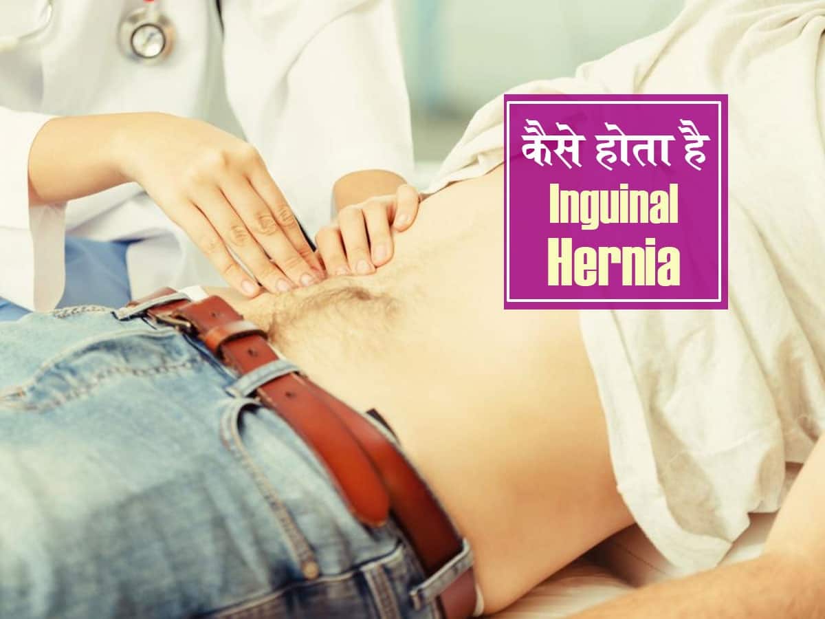 Inguinal Hernia in hindi : शरीर में दिखाई दें ये बदलाव तो समझ लीजिए हो गई हर्निया की शिकायत! पुरुषों में इंफर्टिलिटी का कारण बन सकता है ये हर्निया
